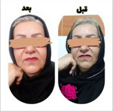 سرم جوانساز بنیادی گل رز