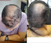 پک برکت رشد مژه و ابرو+ ضد ریزش مو+نرم کننده پوست و مو