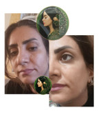 پک جوانساز تضمینی ۱۰ سال جوونتر شو